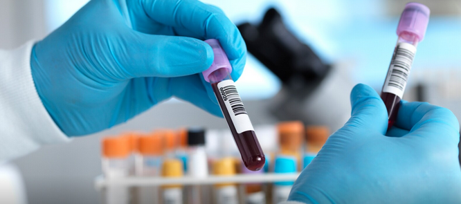 Ce qui change pour les donneurs de sang depuis le 20 mars